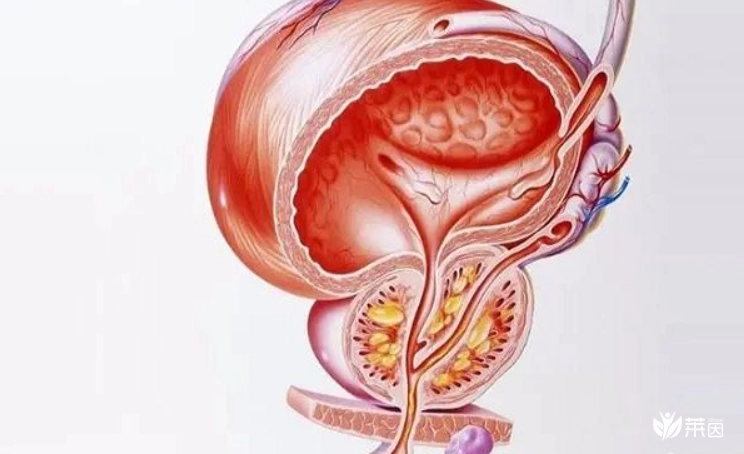 一杯水自测慢性前列腺炎不科学，教你7个检测方法