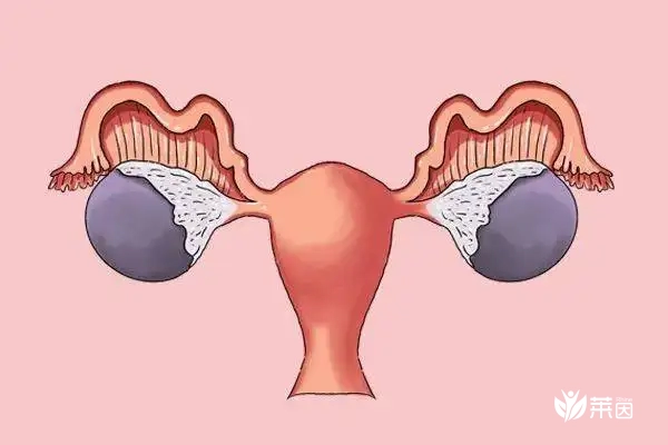 多囊卵巢自怀几率没你想象中的低！积极备孕是必备的！