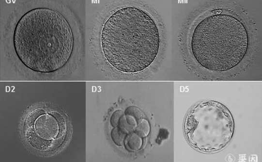 为什么泰国试管婴儿选择囊胚移植？